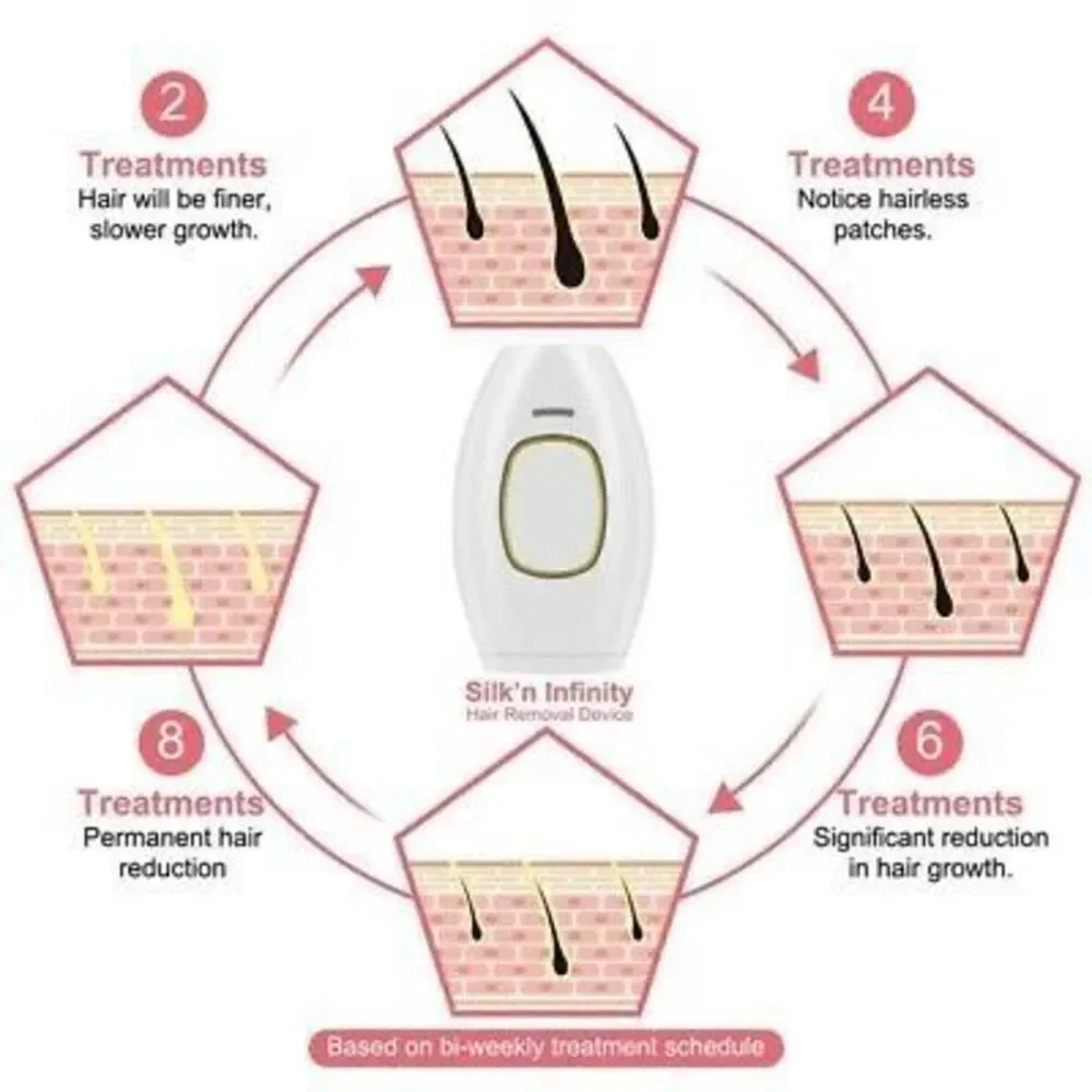 Hey Silky Skin Women's Advanced IPL Hair Removal Handset Rose Gold Pink New